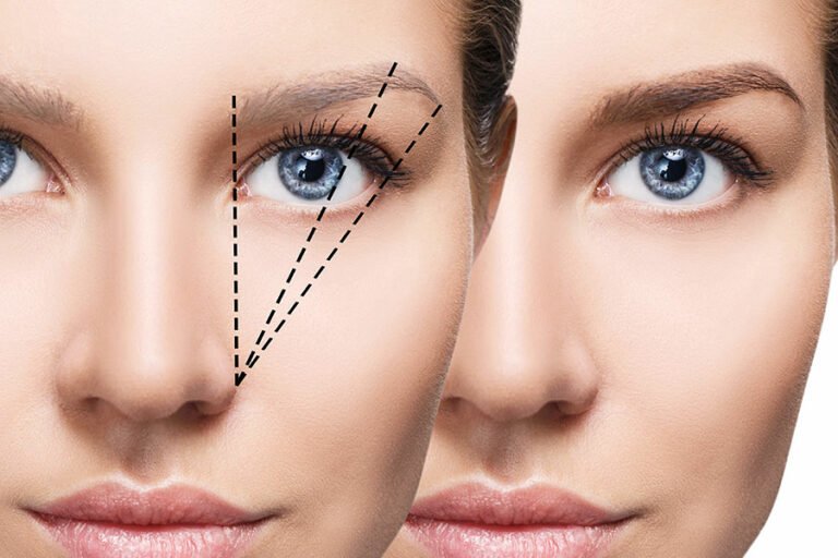 Greffe de sourcils pour les avoir denses épais naturels ou dessinés